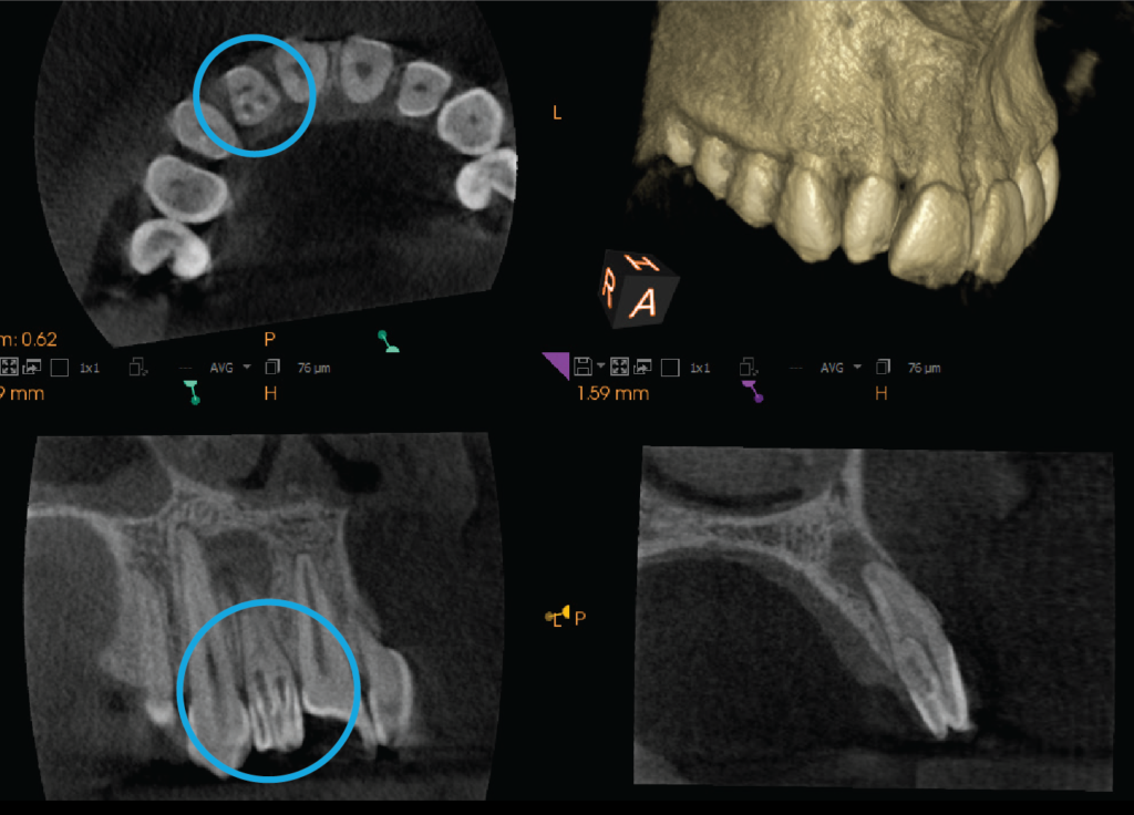 CBCT of atypical anatomy
