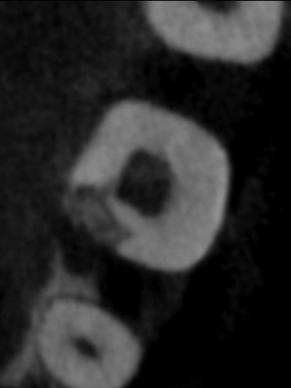 CBCT Axial View