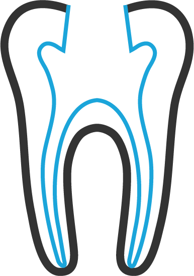 root-canal-retreatment-02
