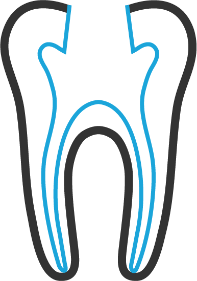 root-canal-treatment-02